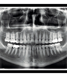 Radiografía Panorámica